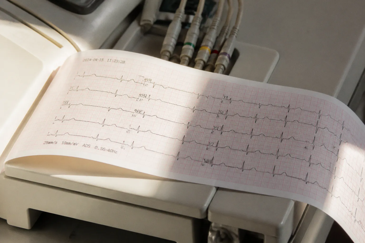 Отзыв ПО Midmark Digital ECG: как ошибки в расчете ЧСС влияют на безопасность диагностики